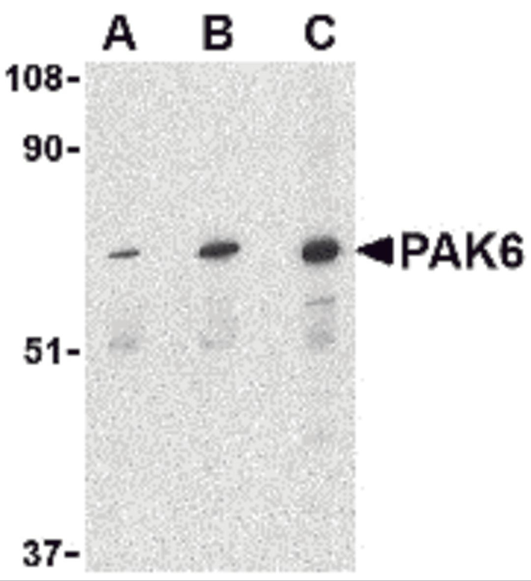 Western blot analysis of PAK6 in Raji lysate with PAK6 antibody at (A) 1, (B) 2, and (C) 4 μg/mL.