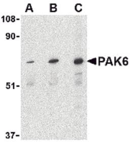Western blot analysis of PAK6 in Raji lysate with PAK6 antibody at (A) 1, (B) 2, and (C) 4 μg/mL.