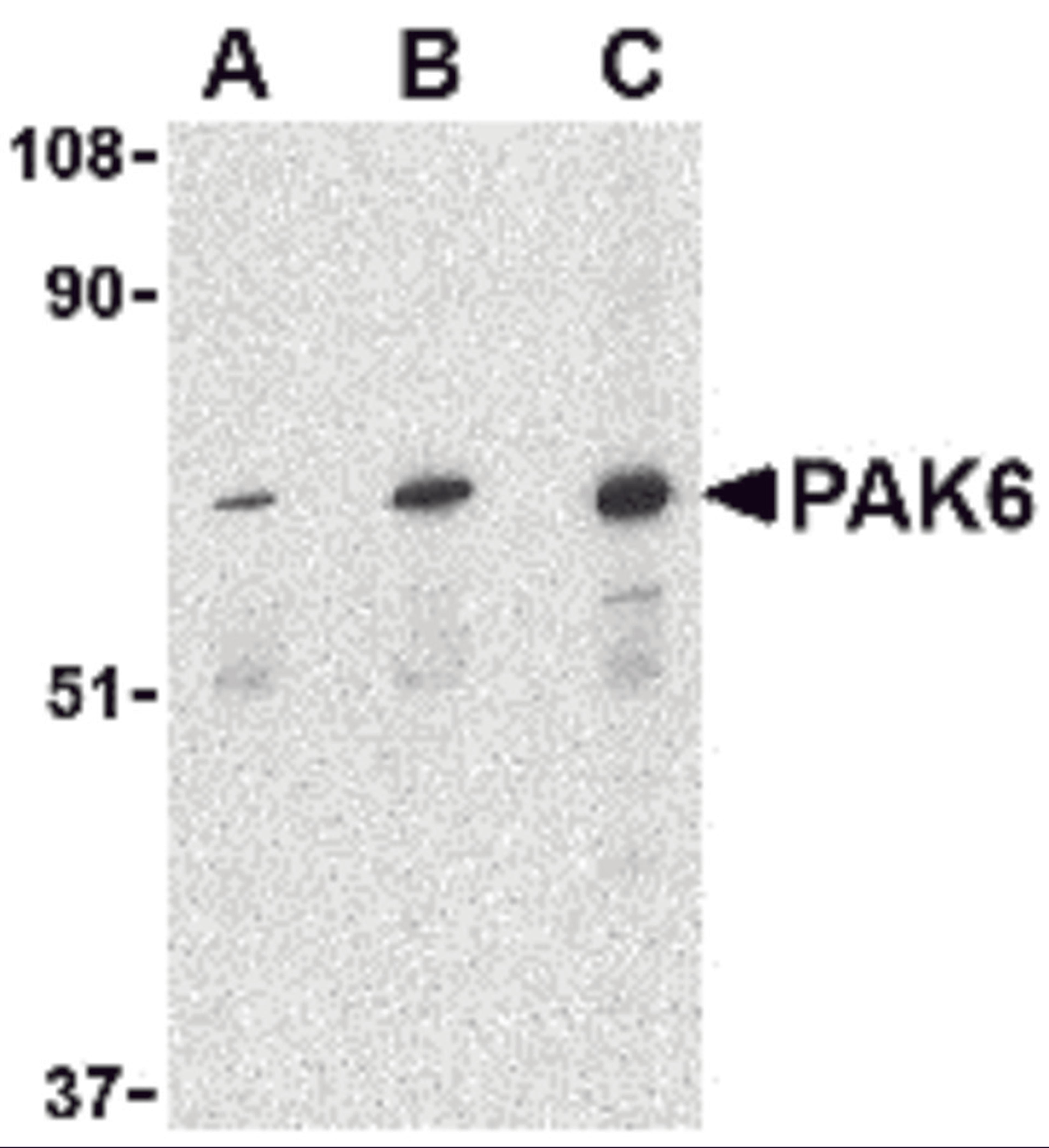 Western blot analysis of PAK6 in Raji lysate with PAK6 antibody at (A) 1, (B) 2, and (C) 4 μg/mL.