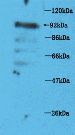 Western Blot of mouse brain tissue using VR1 antibody.