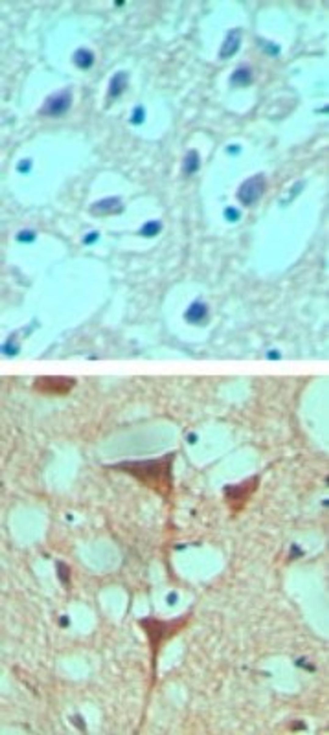 Immunohistochemistry-Paraffin: Smoothened Antibody [NBP2-24543] - Immunohistochemical analysis of Smoothened in formalin-fixed paraffin-embedded human brain tissue using an isotype control antibody (top) and Smoothened antibody (bottom) at 10 ug/ml.