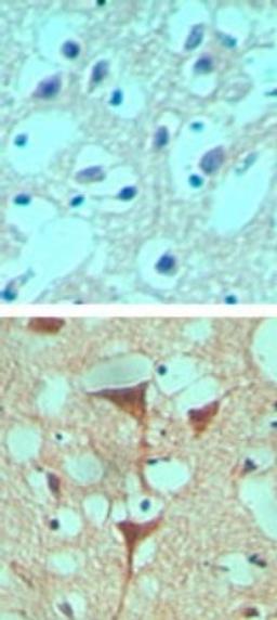 Immunohistochemistry-Paraffin: Smoothened Antibody [NBP2-24543] - Immunohistochemical analysis of Smoothened in formalin-fixed paraffin-embedded human brain tissue using an isotype control antibody (top) and Smoothened antibody (bottom) at 10 ug/ml.