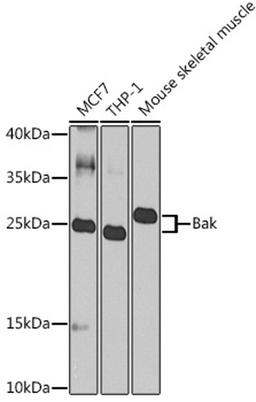 Western blot - Bak Antibody (A0498)