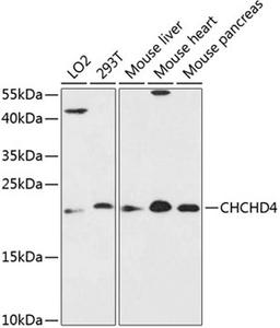 Western blot - CHCHD4 antibody (A13139)