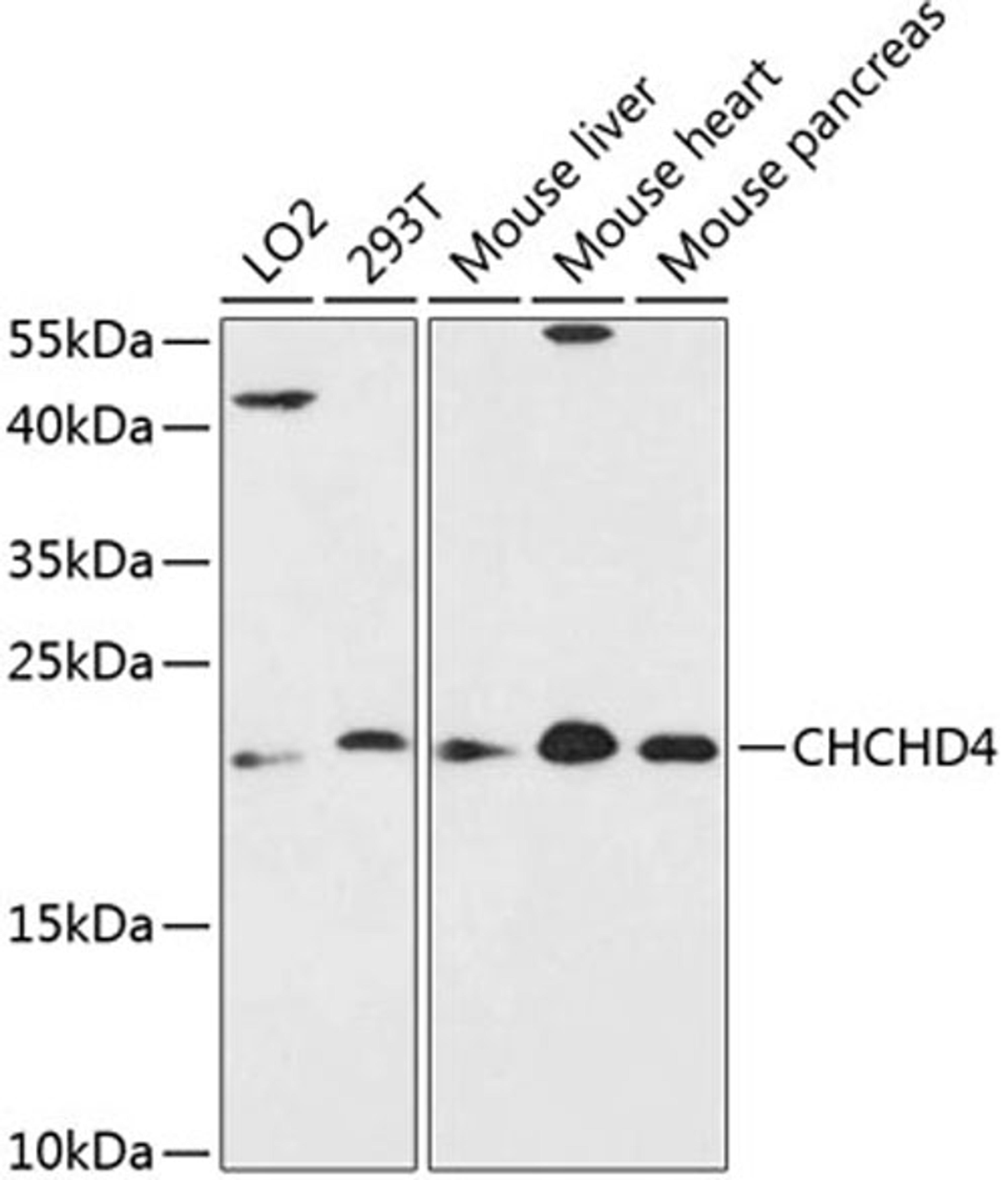 Western blot - CHCHD4 antibody (A13139)