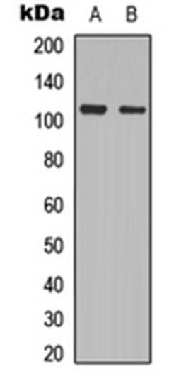 Western blot analysis of HeLa (Lane 1), NIH3T3 (Lane 2) whole cell lysates using PRKD2 (pS876) antibody