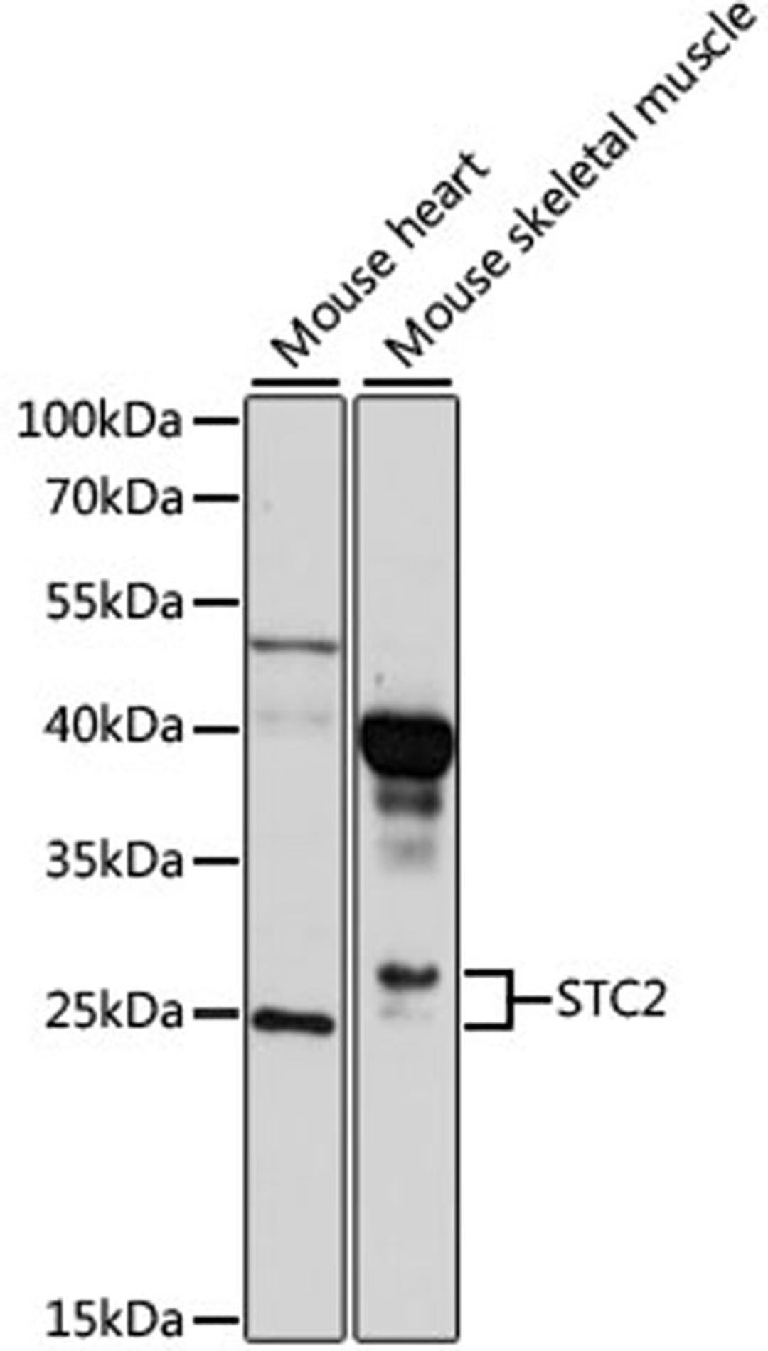 Western blot - STC2 antibody (A10397)