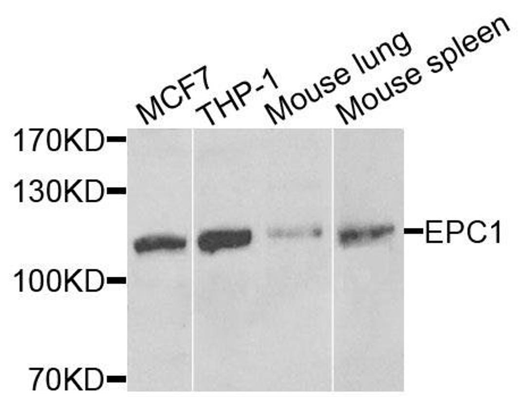 Western blot analysis of extracts of various cells using EPC1 antibody