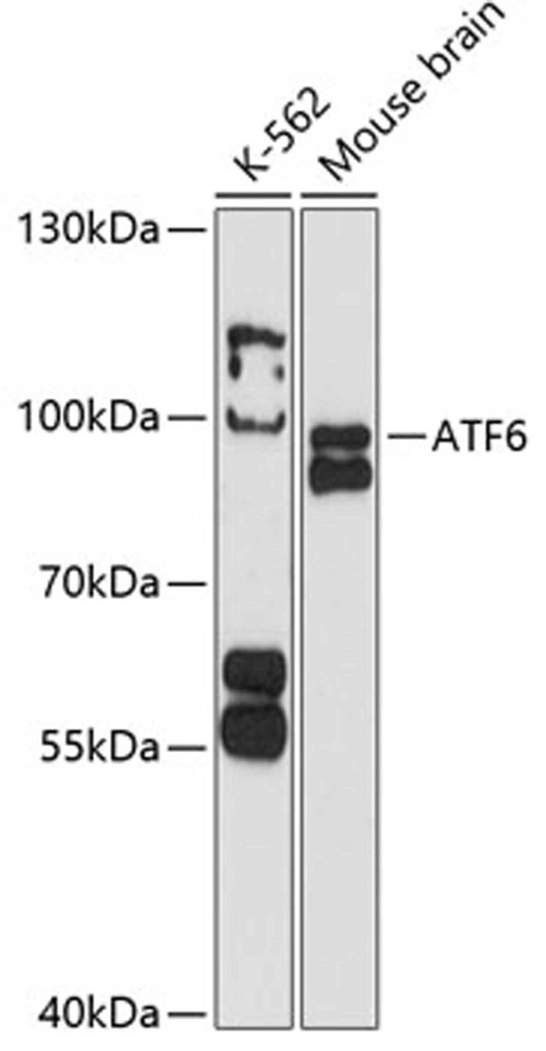 Western blot - ATF6 antibody (A12570)