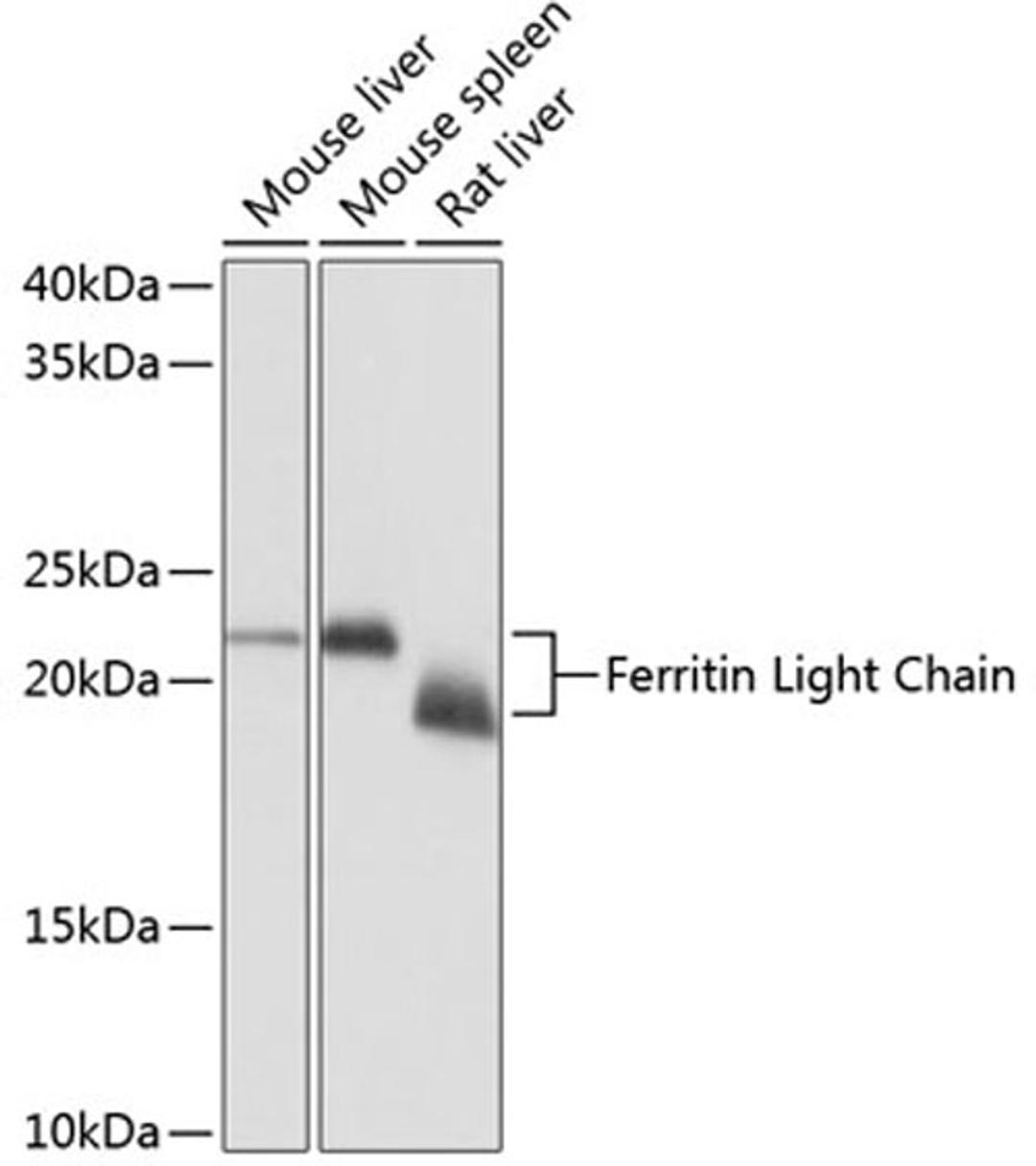 Western blot - Ferritin Light Chain Rabbit mAb (A11241)