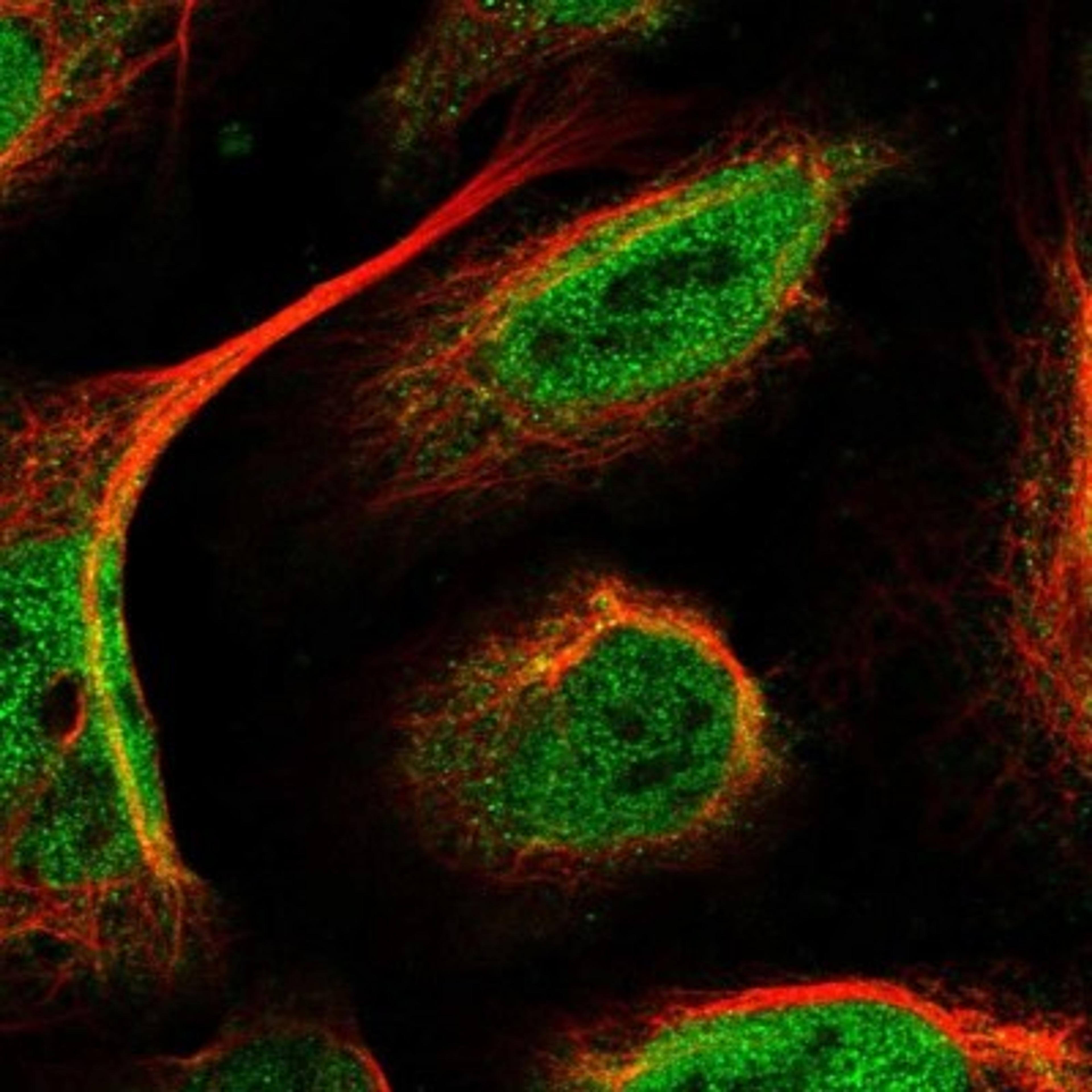 Immunocytochemistry/Immunofluorescence: BARHL2 Antibody [NBP1-85953] - Staining of human cell line U-2 OS shows positivity in nucleus but not nucleoli.