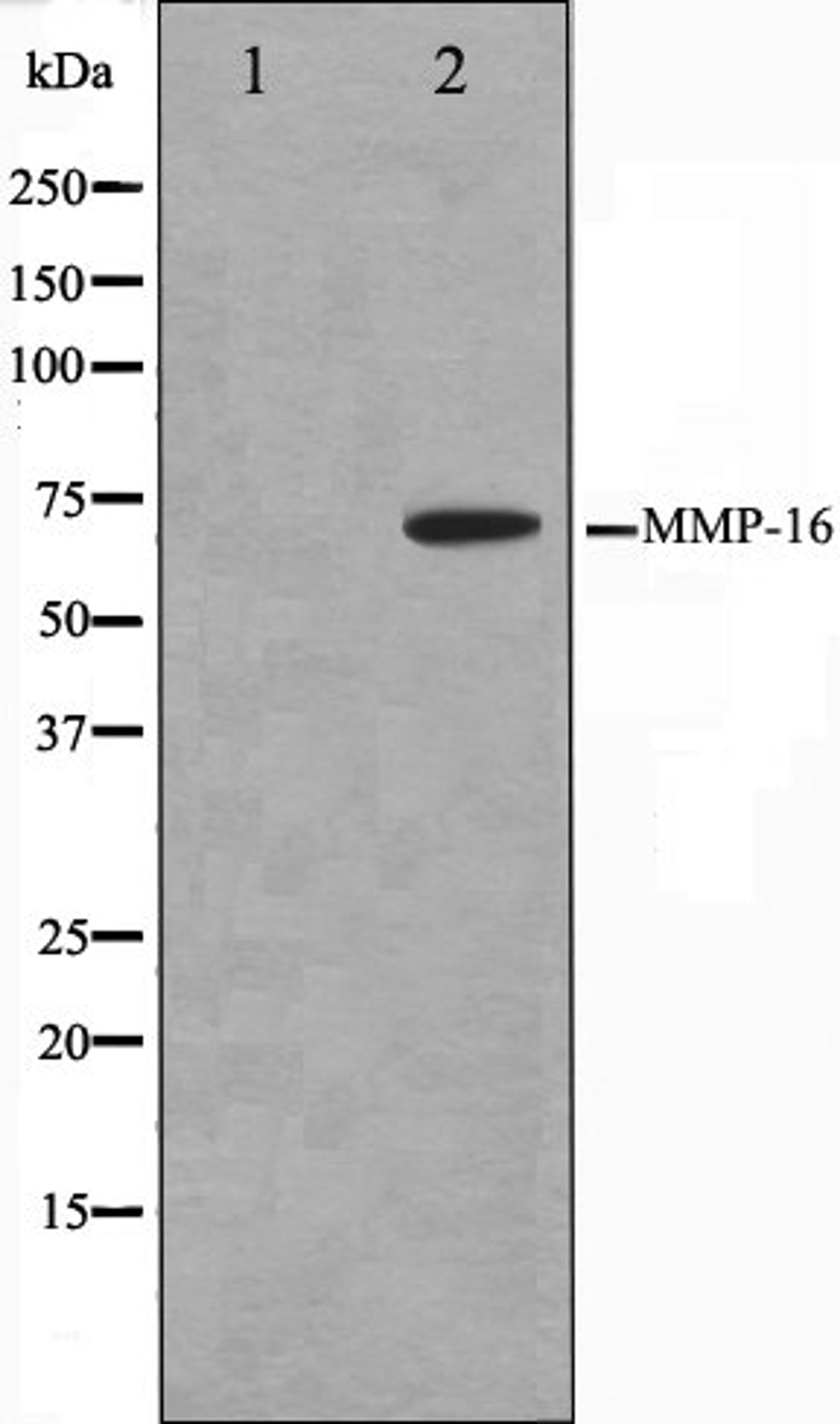 Western blot analysis of HepG2 cell lysate using MMP16 antibody