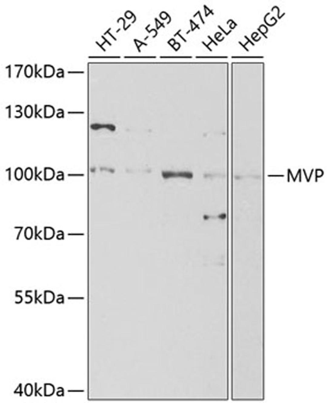 Western blot - MVP antibody (A1980)