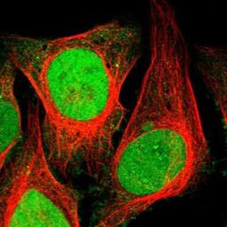 Immunocytochemistry/Immunofluorescence: NSBP1 Antibody [NBP1-87379] - Staining of human cell line U-2 OS shows positivity in nucleus & nucleoli.