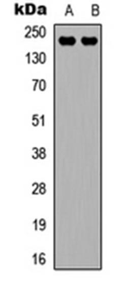 Western blot analysis of MCF (Lane 1), HepG2 (Lane 2) whole cell lysates using VEGFR2 antibody