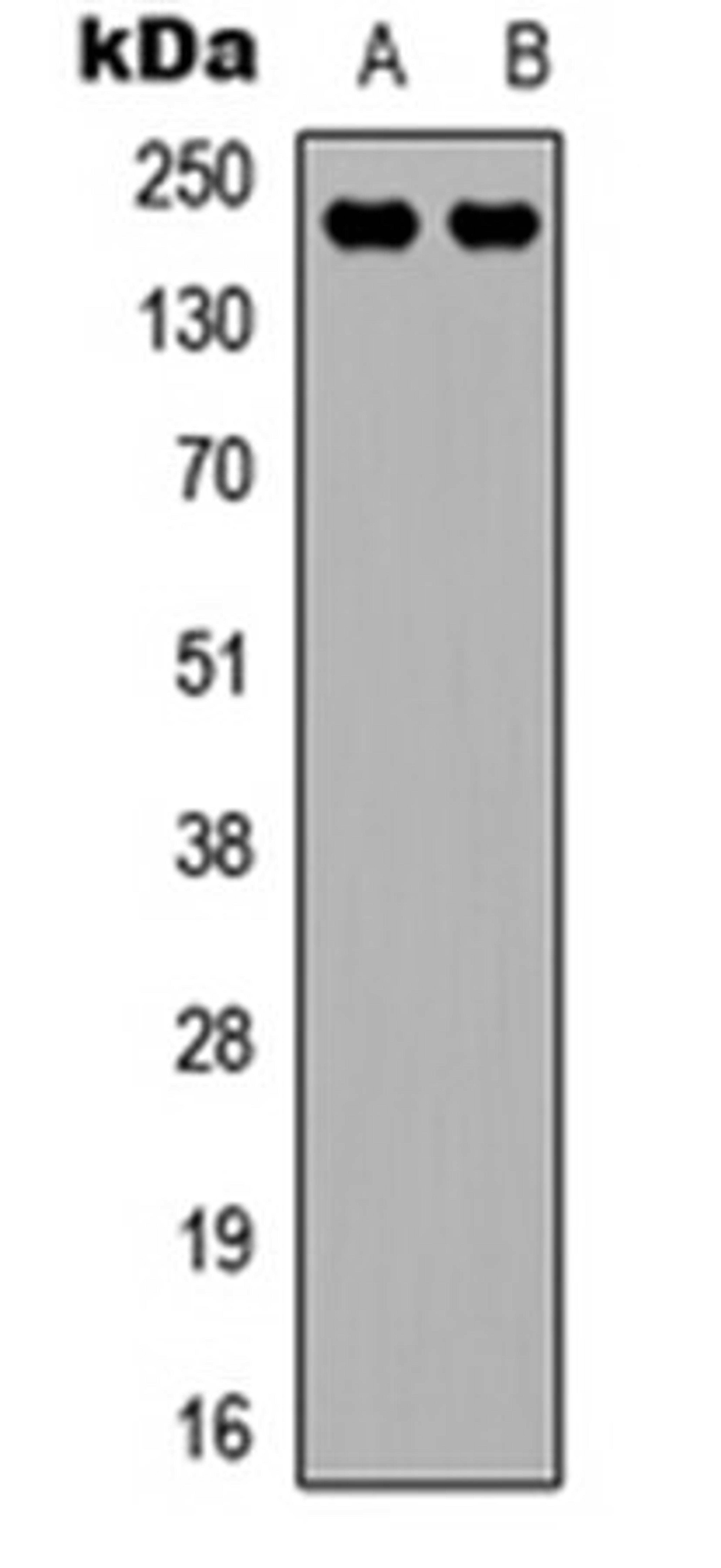 Western blot analysis of MCF (Lane 1), HepG2 (Lane 2) whole cell lysates using VEGFR2 antibody