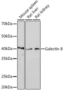 Western blot - Galectin 8 Rabbit mAb (A4383)