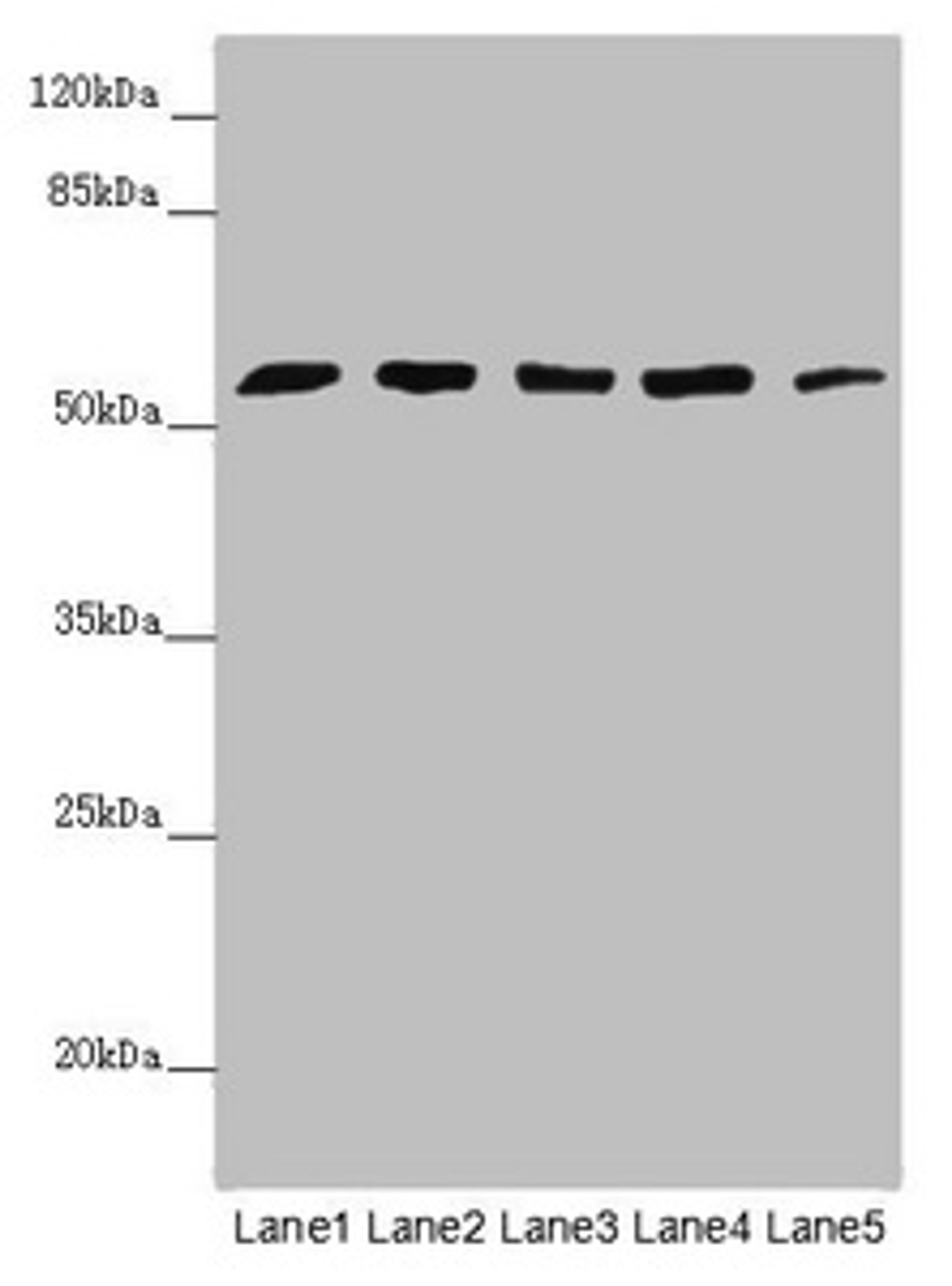 Western blot. All lanes: CEP57L1 antibody at 6.26µg/ml. Lane 1: CEM whole cell lysate. Lane 2: 293T whole cell lysate. Lane 3: Hela whole cell lysate. Lane 4: Jurkat whole cell lysate. Lane 5: A549 whole cell lysate. Secondary. Goat polyclonal to rabbit IgG at 1/10000 dilution. Predicted band size: 54, 46 kDa. Observed band size: 54 kDa