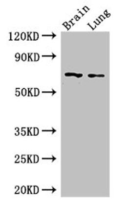 Western Blot. Positive WB detected in: Mouse brain tissue, Mouse lung tissue. All lanes: FOXO1 antibody at 2.5ug/ml. Secondary. Goat polyclonal to rabbit IgG at 1/50000 dilution. Predicted band size: 70 kDa. Observed band size: 70 kDa. 