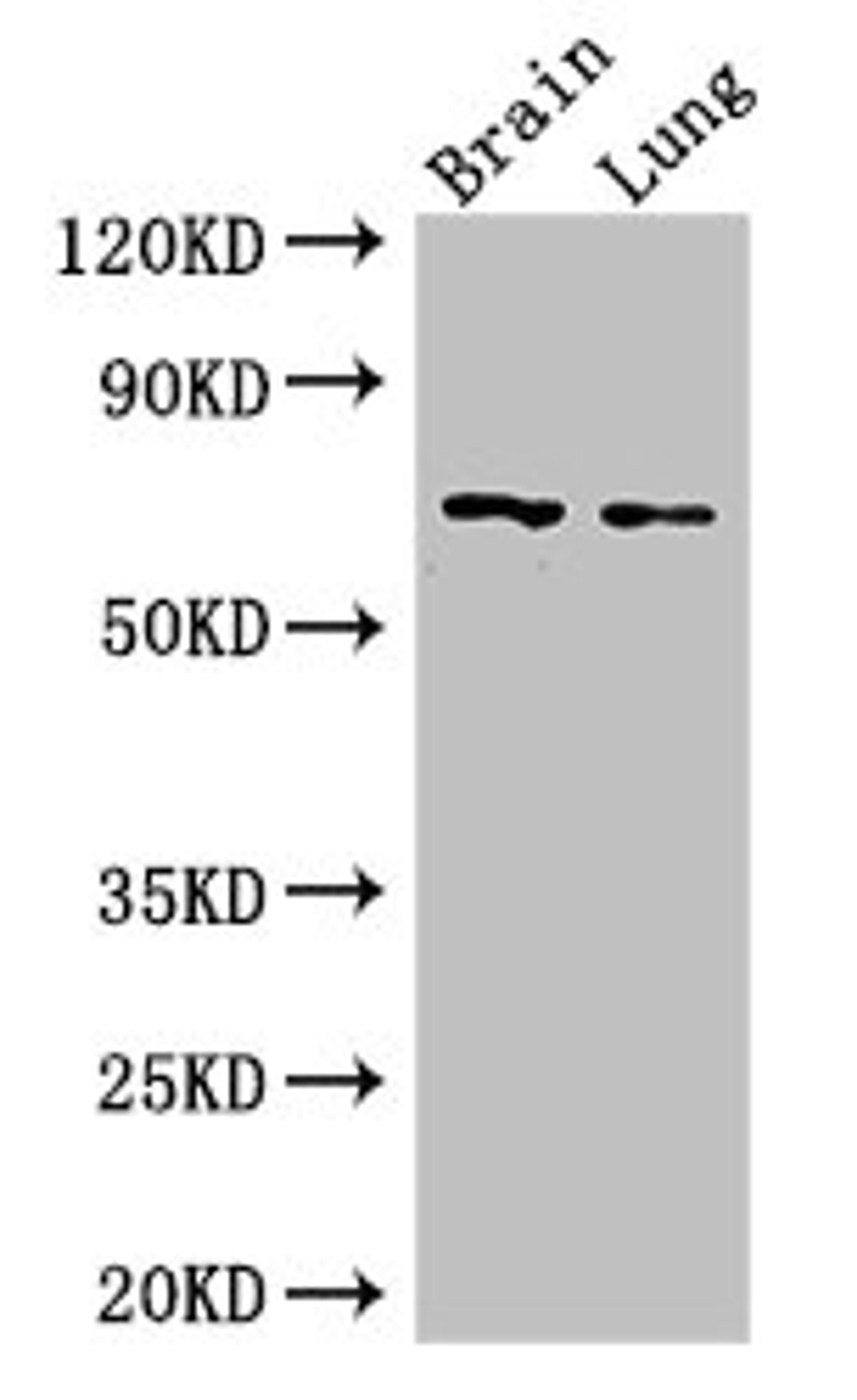 Western Blot. Positive WB detected in: Mouse brain tissue, Mouse lung tissue. All lanes: FOXO1 antibody at 2.5ug/ml. Secondary. Goat polyclonal to rabbit IgG at 1/50000 dilution. Predicted band size: 70 kDa. Observed band size: 70 kDa. 