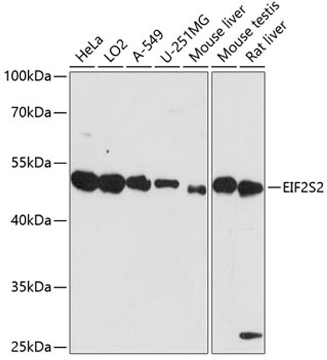 Western blot - EIF2S2 antibody (A14498)