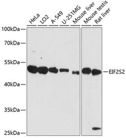 Western blot - EIF2S2 antibody (A14498)