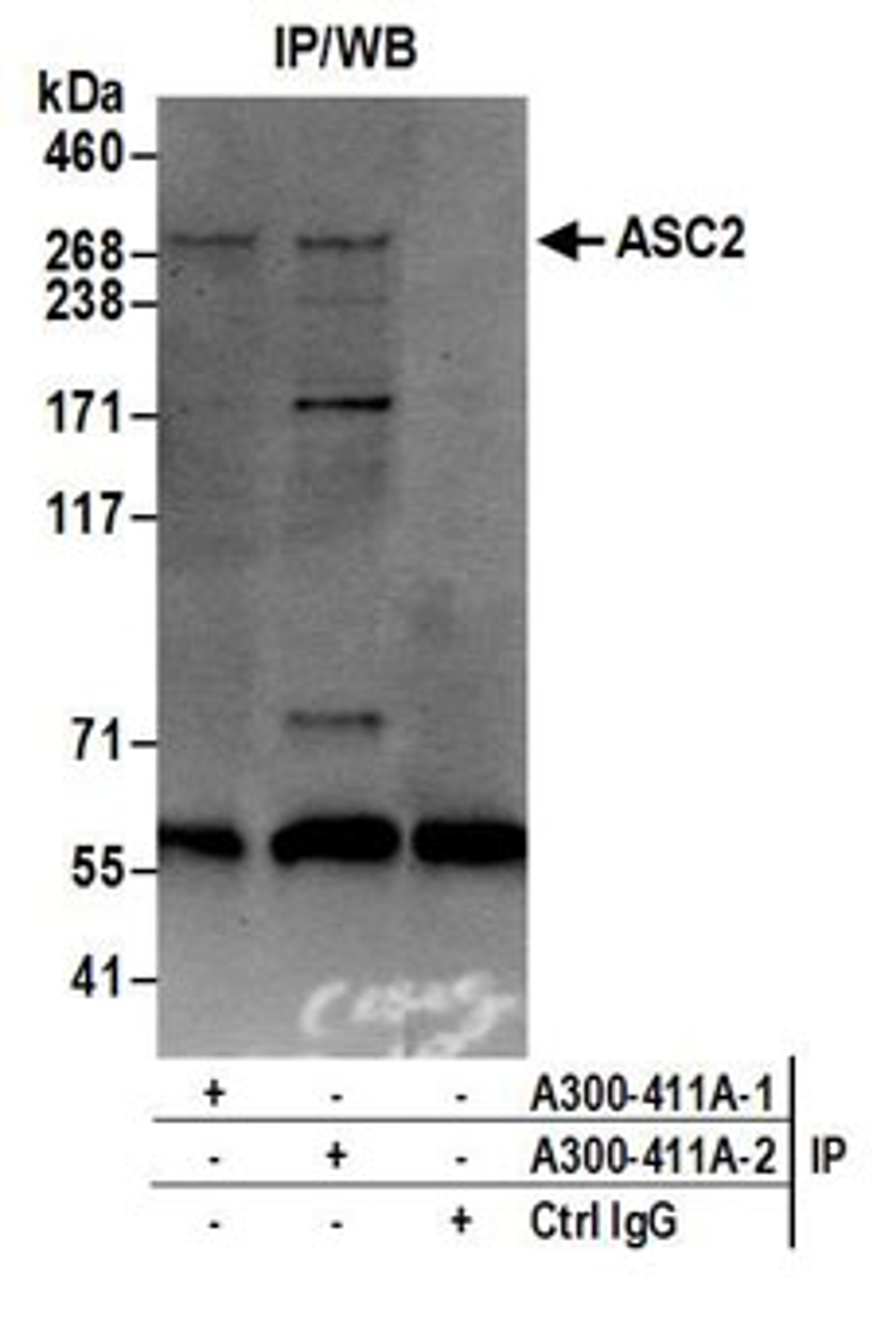 Detection of human ASC2 by western blot of immunoprecipitates.