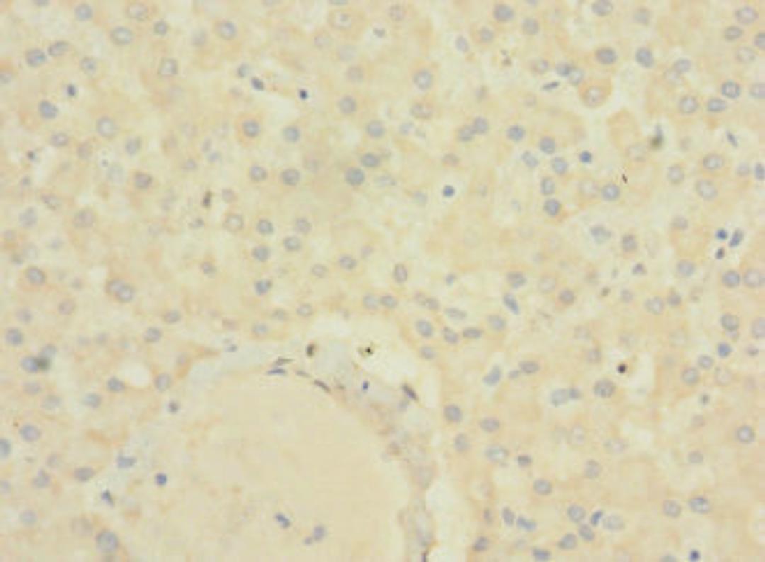 Immunohistochemistry of paraffin-embedded human liver tissue using CSB-PA811607LA01HU at dilution of 1:100