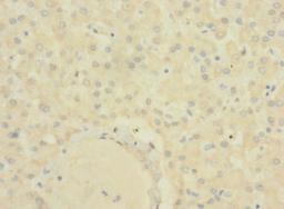 Immunohistochemistry of paraffin-embedded human liver tissue using CSB-PA811607LA01HU at dilution of 1:100