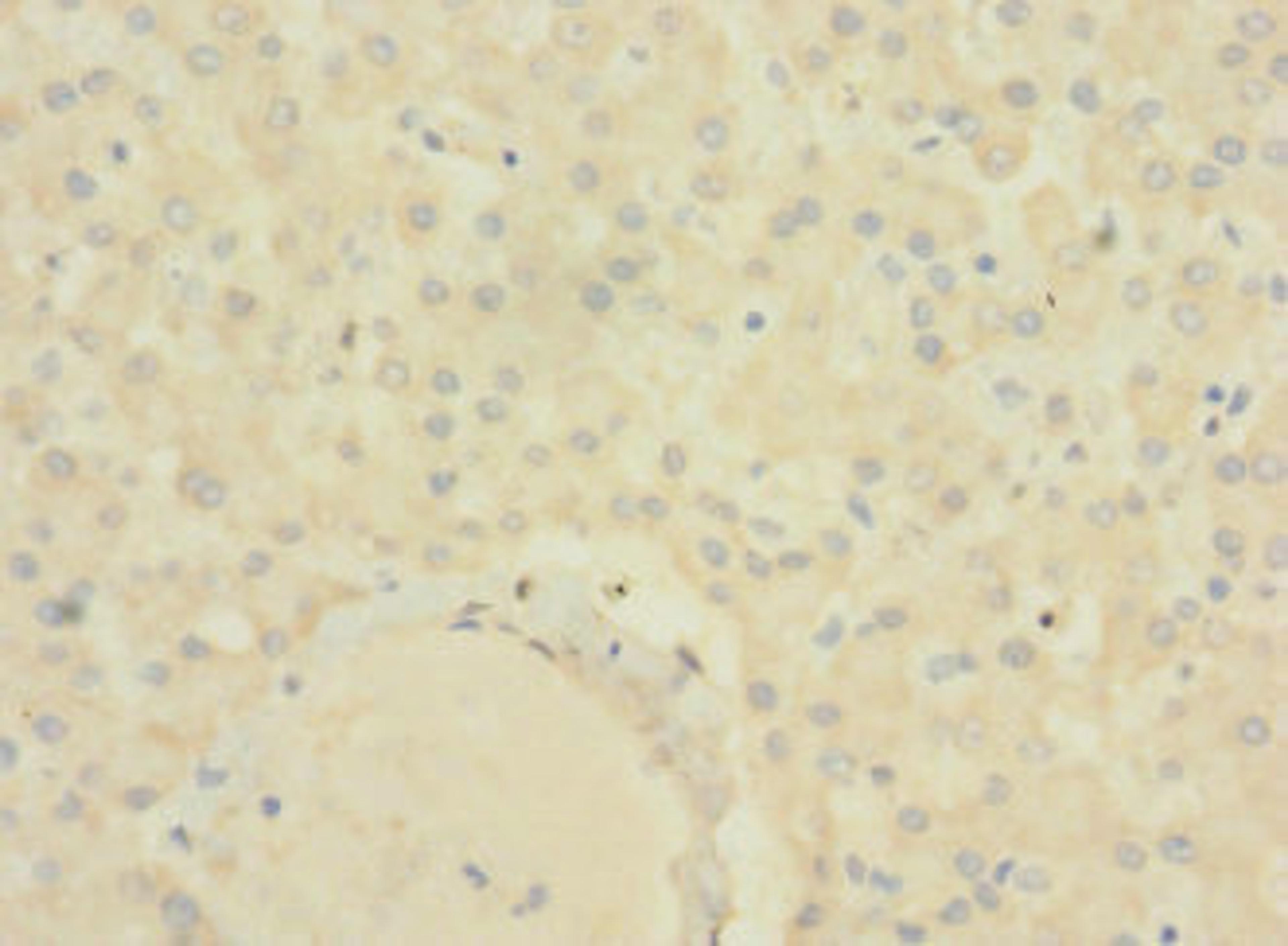 Immunohistochemistry of paraffin-embedded human liver tissue using CSB-PA811607LA01HU at dilution of 1:100