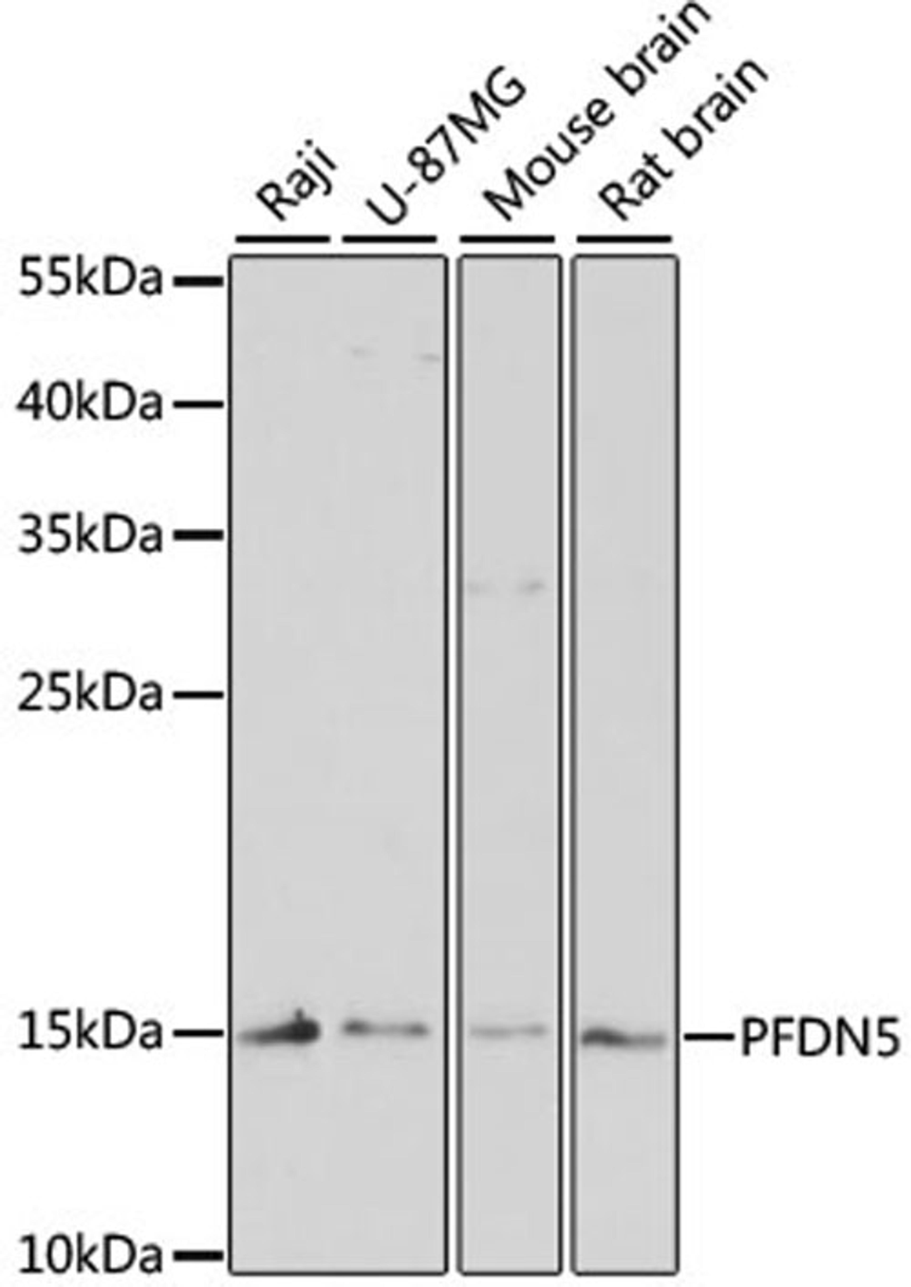 Western blot - PFDN5 antibody (A4014)