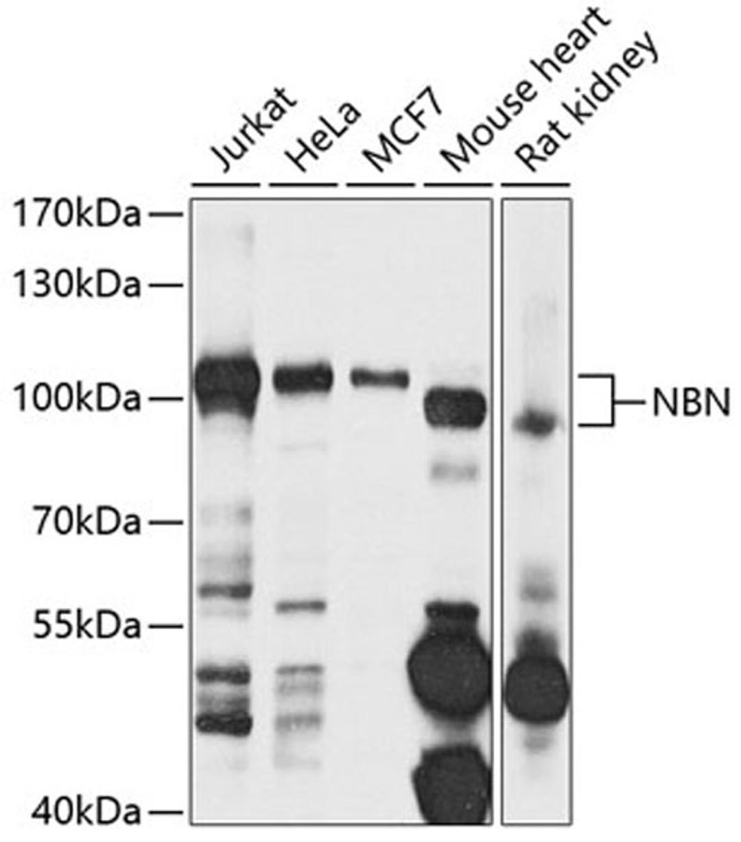 Western blot - NBN antibody (A7703)