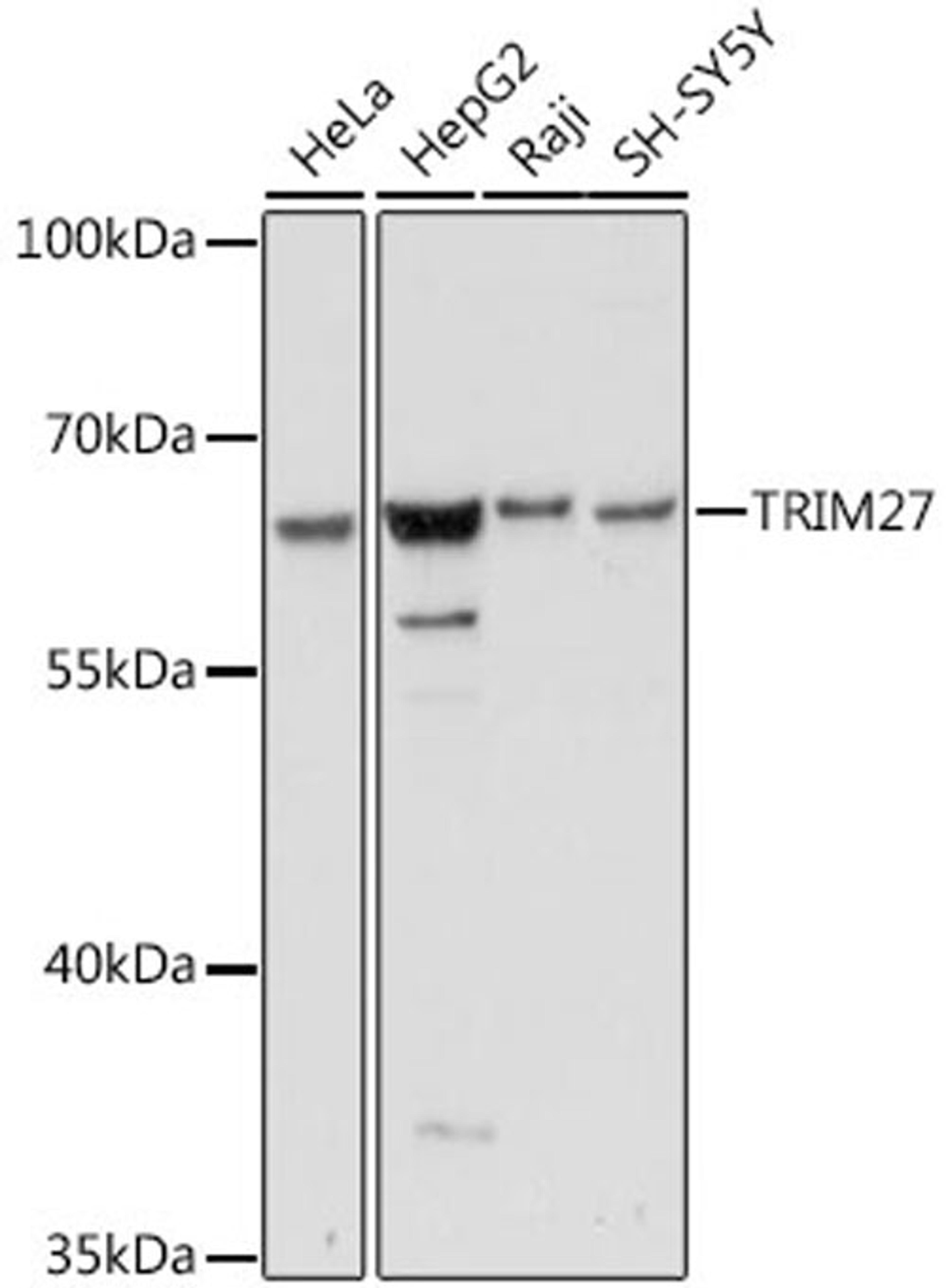 Western blot - TRIM27 antibody (A16065)