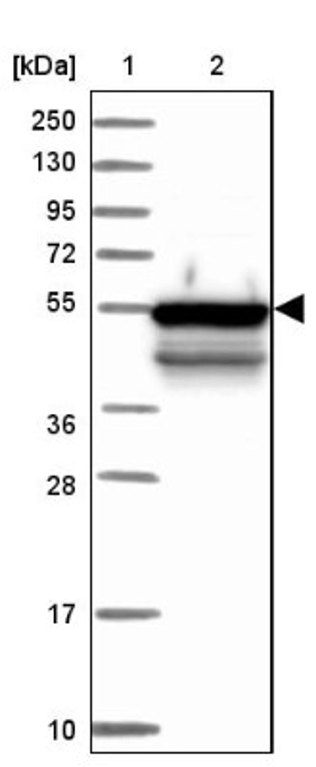 Western Blot: STK23 Antibody [NBP1-92452] - Lane 1: Marker [kDa] 250, 130, 95, 72, 55, 36, 28, 17, 10<br/>Lane 2: Human cell line RT-4