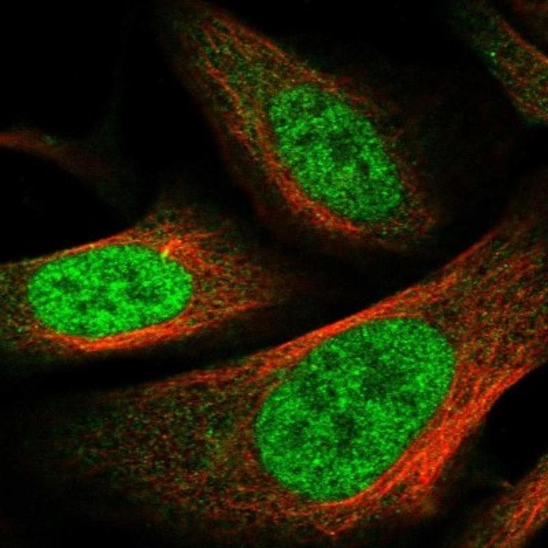 Immunocytochemistry/Immunofluorescence: PPIL4 Antibody [NBP1-85921] - Immunofluorescent staining of human cell line U-2 OS shows positivity in nucleus but not nucleoli & cytoplasm.