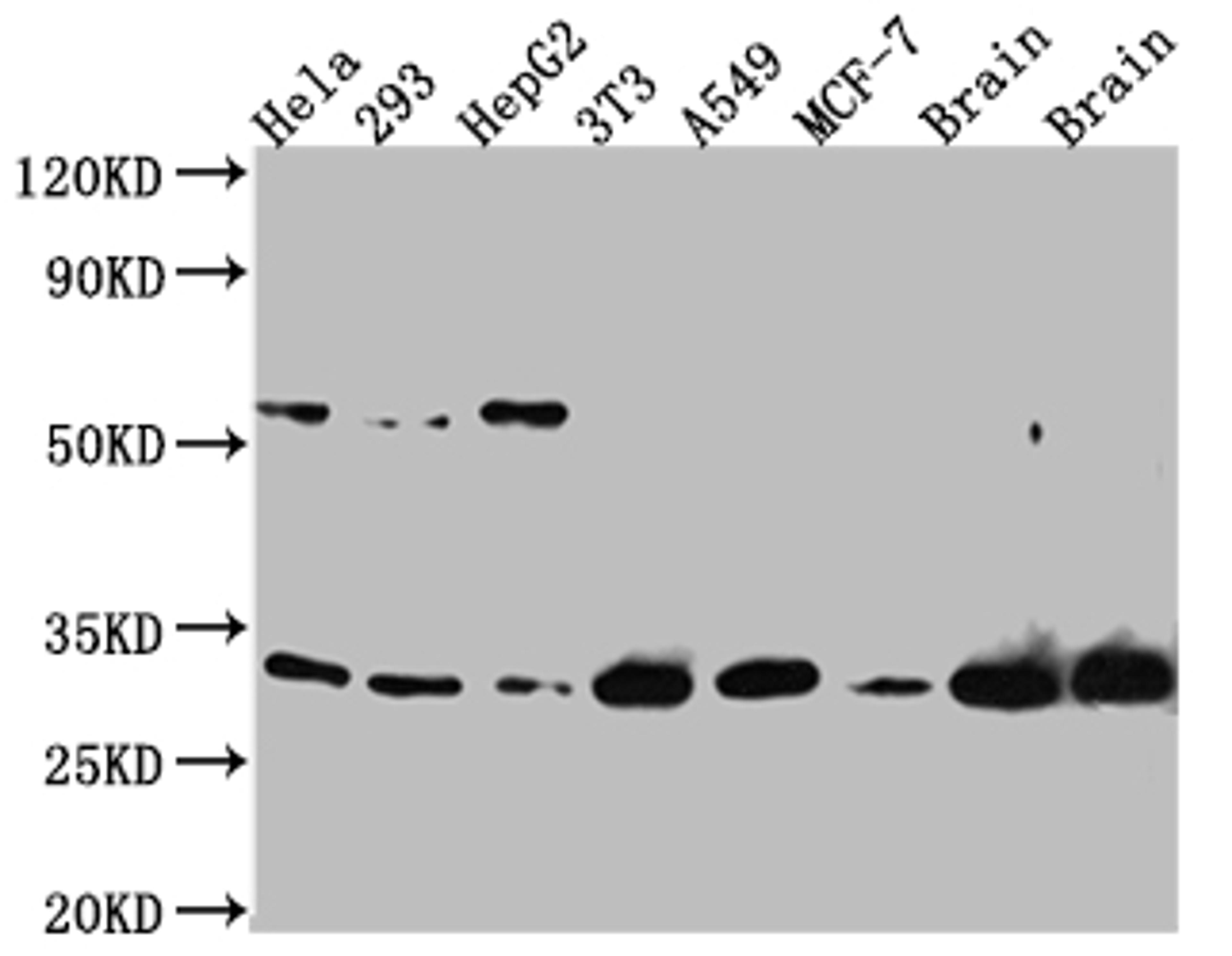 Western Blot. Positive WB detected in: Hela whole cell lysate, 293 whole cell lysate, HepG2 whole cell lysate, NIH/3T3 whole cell lysate, A549 whole cell lysate, MCF-7 whole cell lysate, Mouse Brain whole cell lysate, Rat Brain whole cell lysate. All lanes: PGAM1 Antibody at 1:1000. Secondary. Goat polyclonal to rabbit IgG at 1/50000 dilution. Predicted band size: 28 kDa. Observed band size: 29 kDa. 