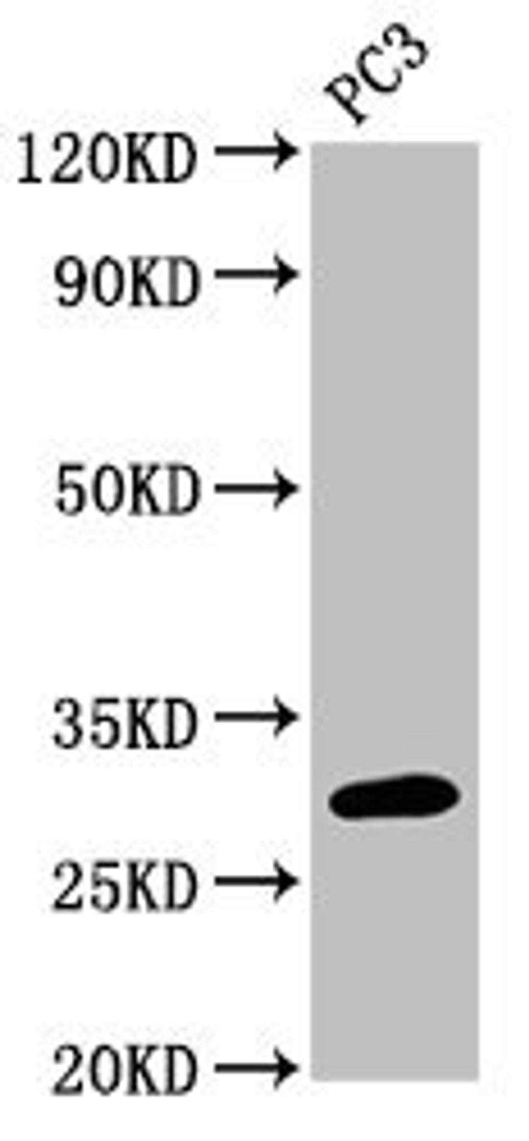 Western Blot. Positive WB detected in: PC-3 whole cell lysate. All lanes: MRO antibody at 3µg/ml. Secondary. Goat polyclonal to rabbit IgG at 1/50000 dilution. Predicted band size: 30, 25, 31, 24 kDa. Observed band size: 30 kDa