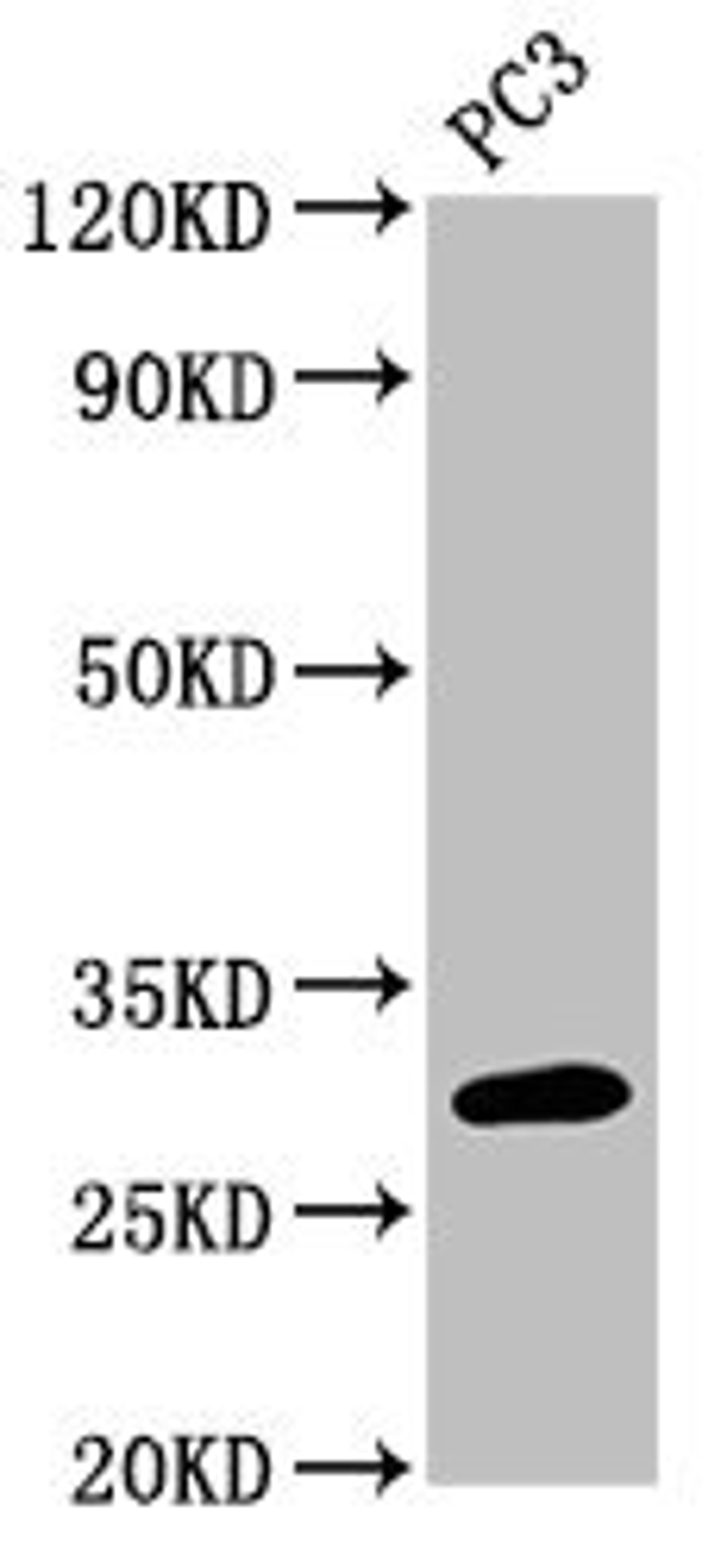 Western Blot. Positive WB detected in: PC-3 whole cell lysate. All lanes: MRO antibody at 3µg/ml. Secondary. Goat polyclonal to rabbit IgG at 1/50000 dilution. Predicted band size: 30, 25, 31, 24 kDa. Observed band size: 30 kDa