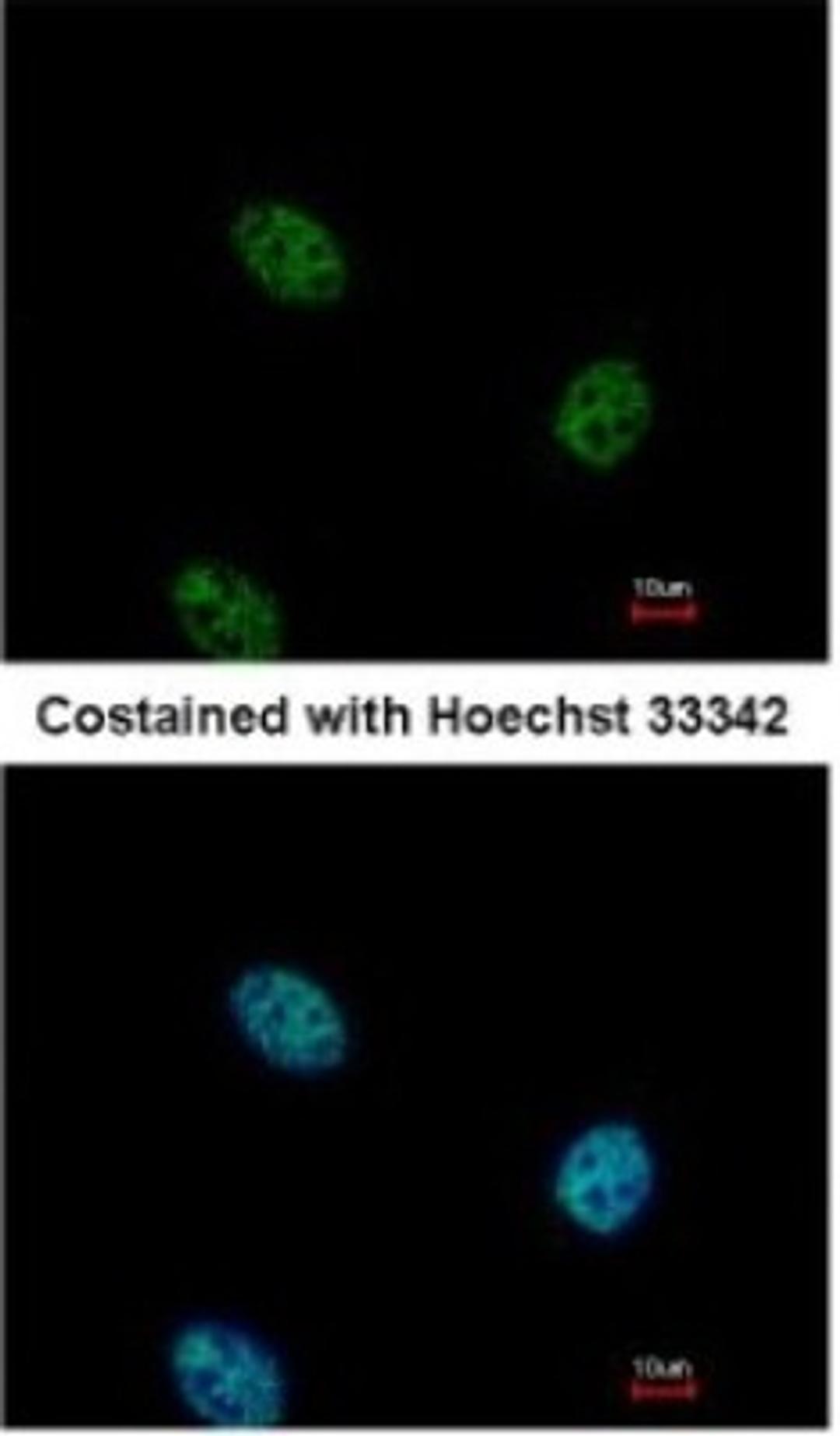 Immunocytochemistry/Immunofluorescence: EHF Antibody [NBP2-14942] - Paraformaldehyde-fixed HeLa, using antibody at 1:500 dilution.