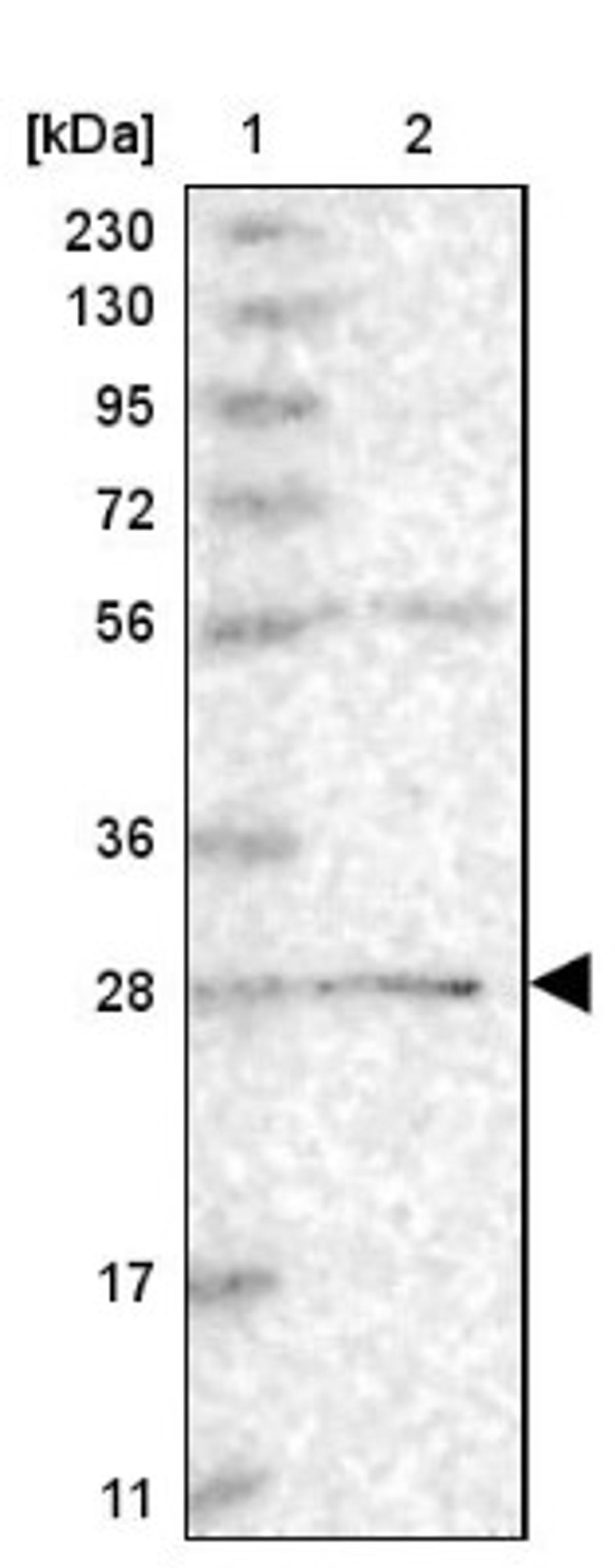 Western Blot: BPHL Antibody [NBP2-38328] - Lane 1: Marker [kDa] 230, 130, 95, 72, 56, 36, 28, 17, 11<br/>Lane 2: RT-4