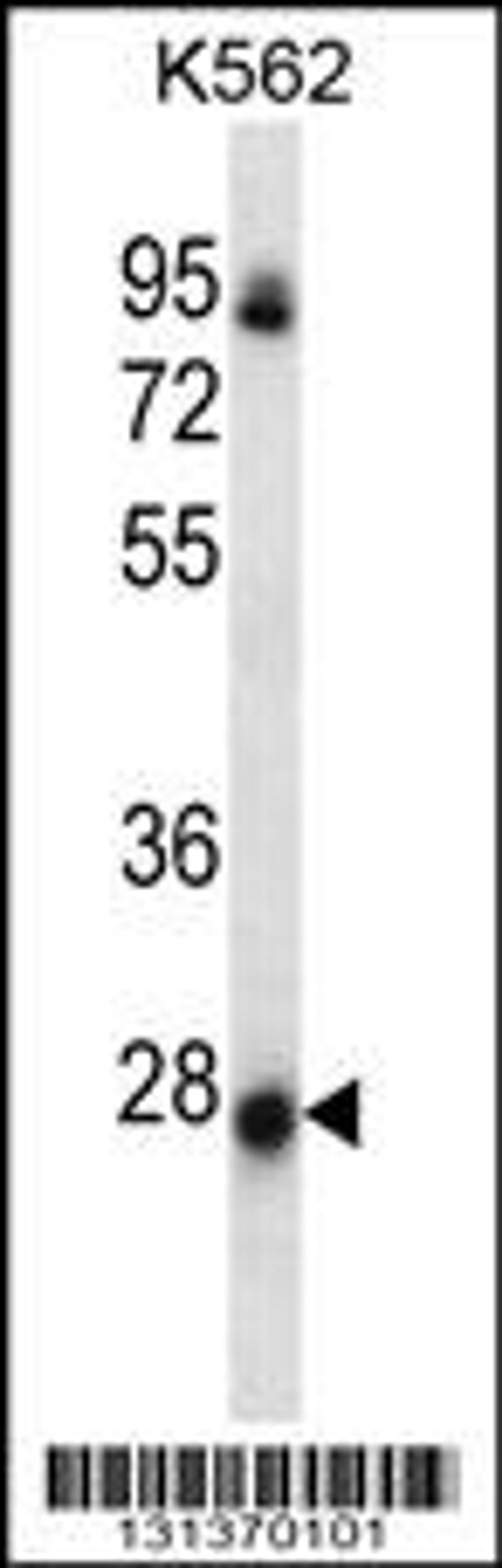 Western blot analysis in K562 cell line lysates (35ug/lane).