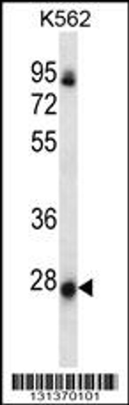 Western blot analysis in K562 cell line lysates (35ug/lane).