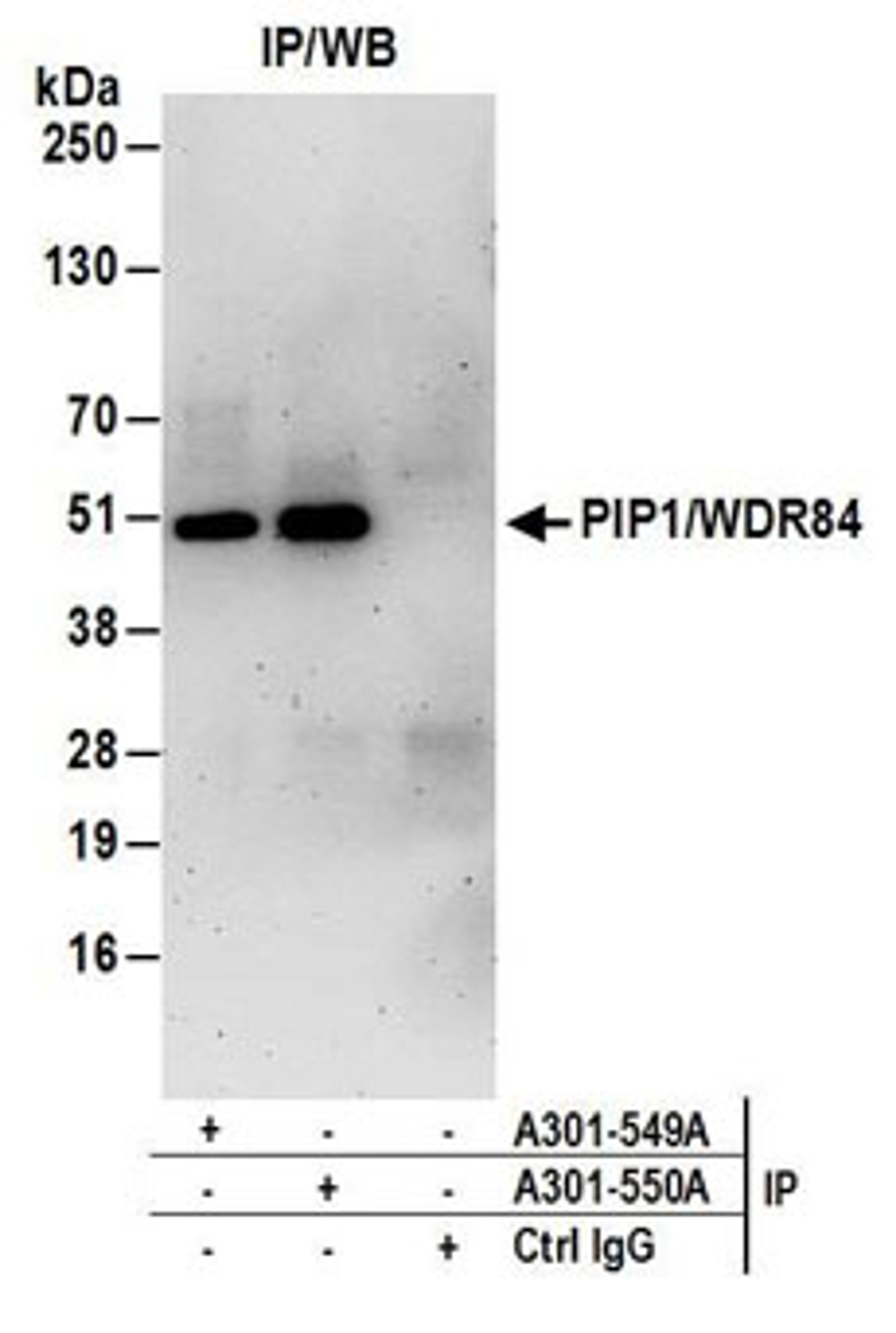 Detection of human PIP1/WDR84 by western blot of immunoprecipitates.