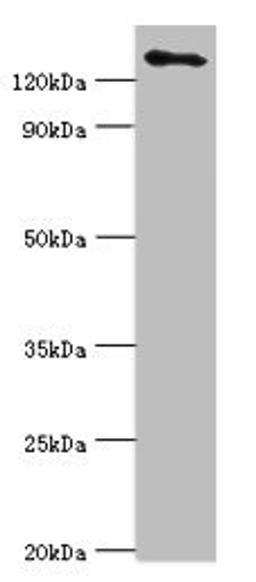 Western blot. All lanes: USP8 antibody at 14ug/ml + 293T whole cell lysate. Secondary. Goat polyclonal to rabbit IgG at 1/10000 dilution. Predicted band size: 128, 116 kDa. Observed band size: 128 kDa.