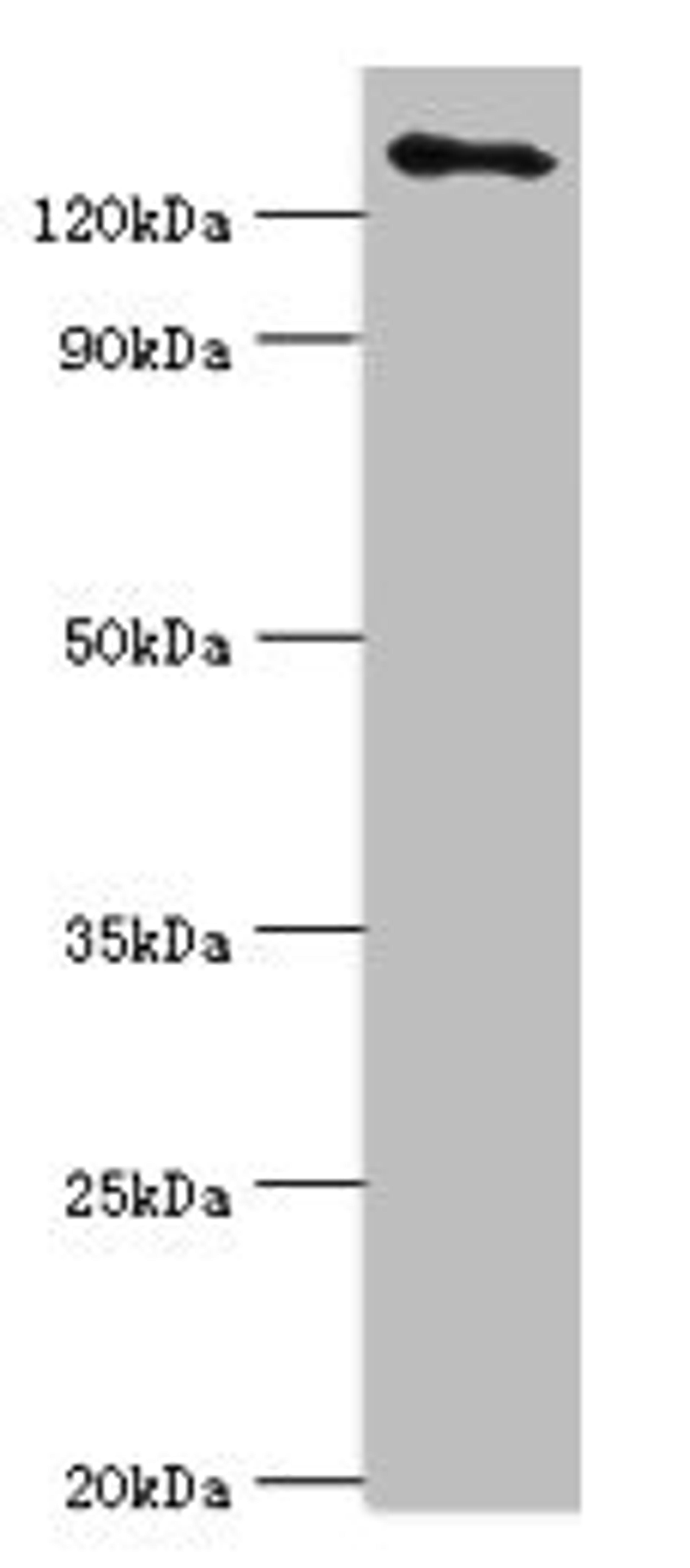 Western blot. All lanes: USP8 antibody at 14ug/ml + 293T whole cell lysate. Secondary. Goat polyclonal to rabbit IgG at 1/10000 dilution. Predicted band size: 128, 116 kDa. Observed band size: 128 kDa.