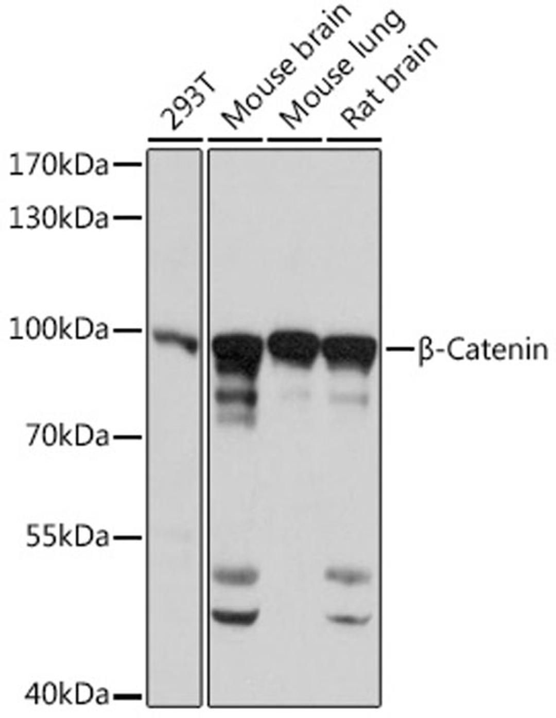 Western blot - ß-Catenin antibody (A11932)