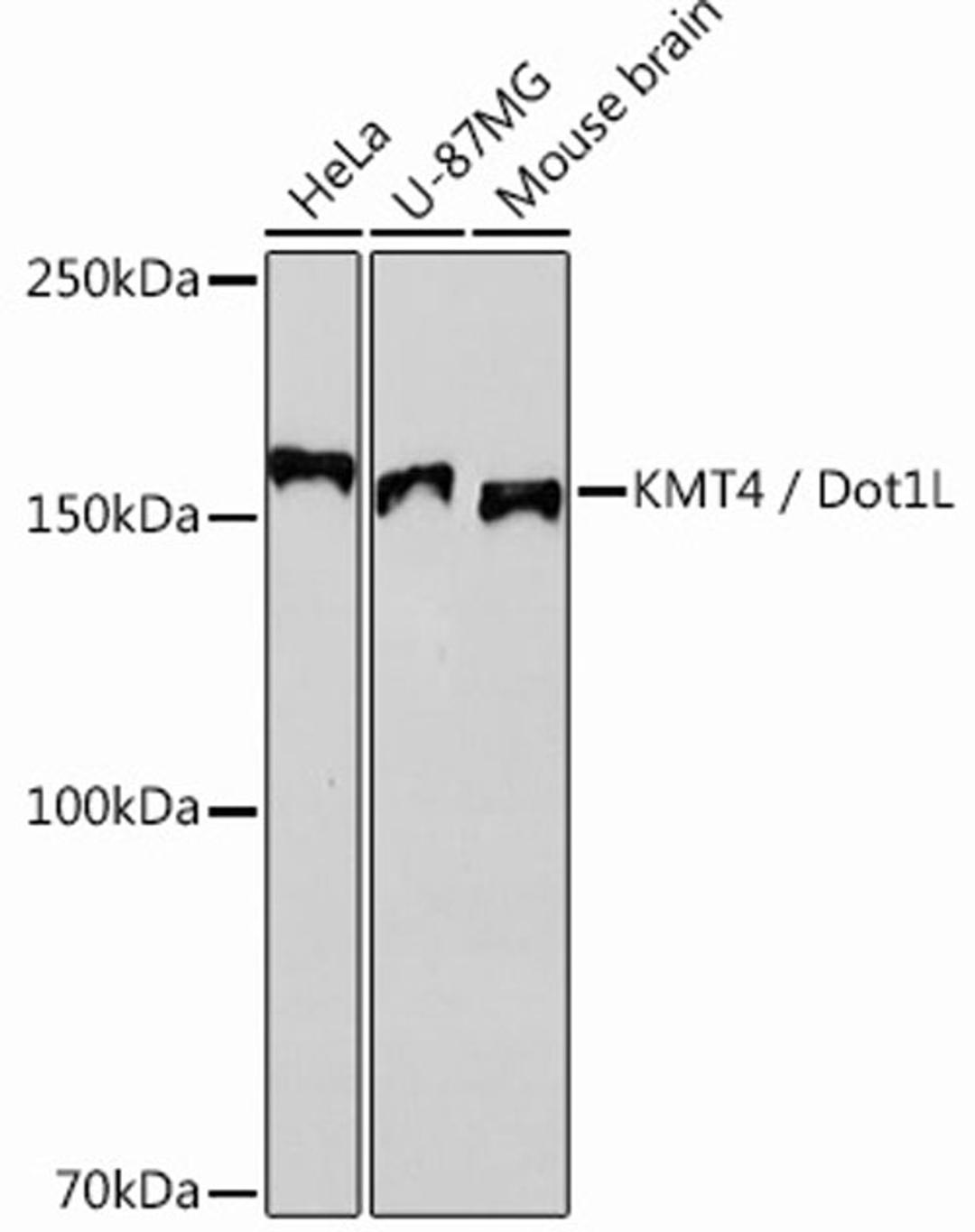 Western blot - KMT4 / Dot1L Rabbit mAb (A12329)