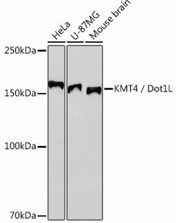 Western blot - KMT4 / Dot1L Rabbit mAb (A12329)