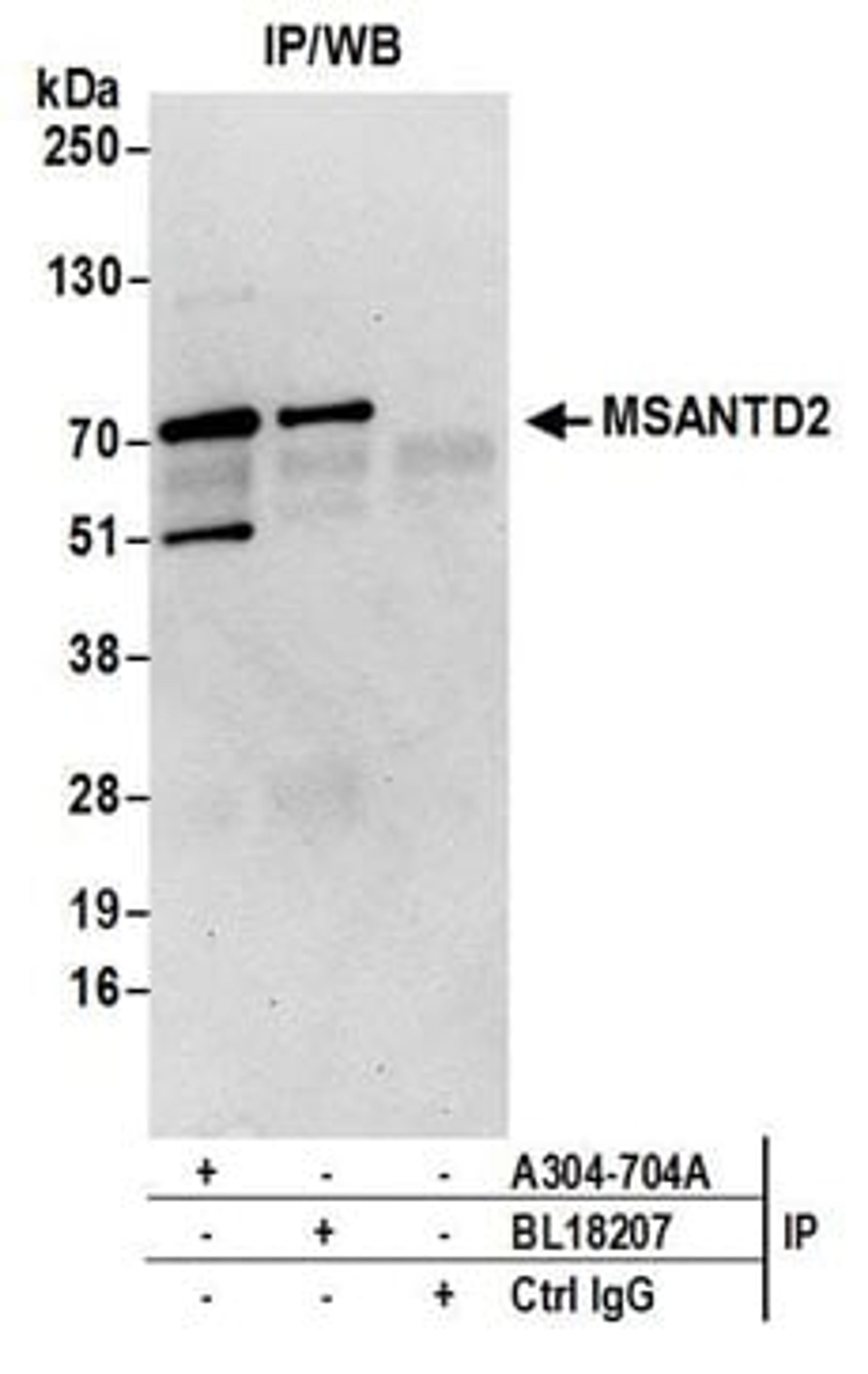 Detection of human MSANTD2 by western blot of immunoprecipitates.