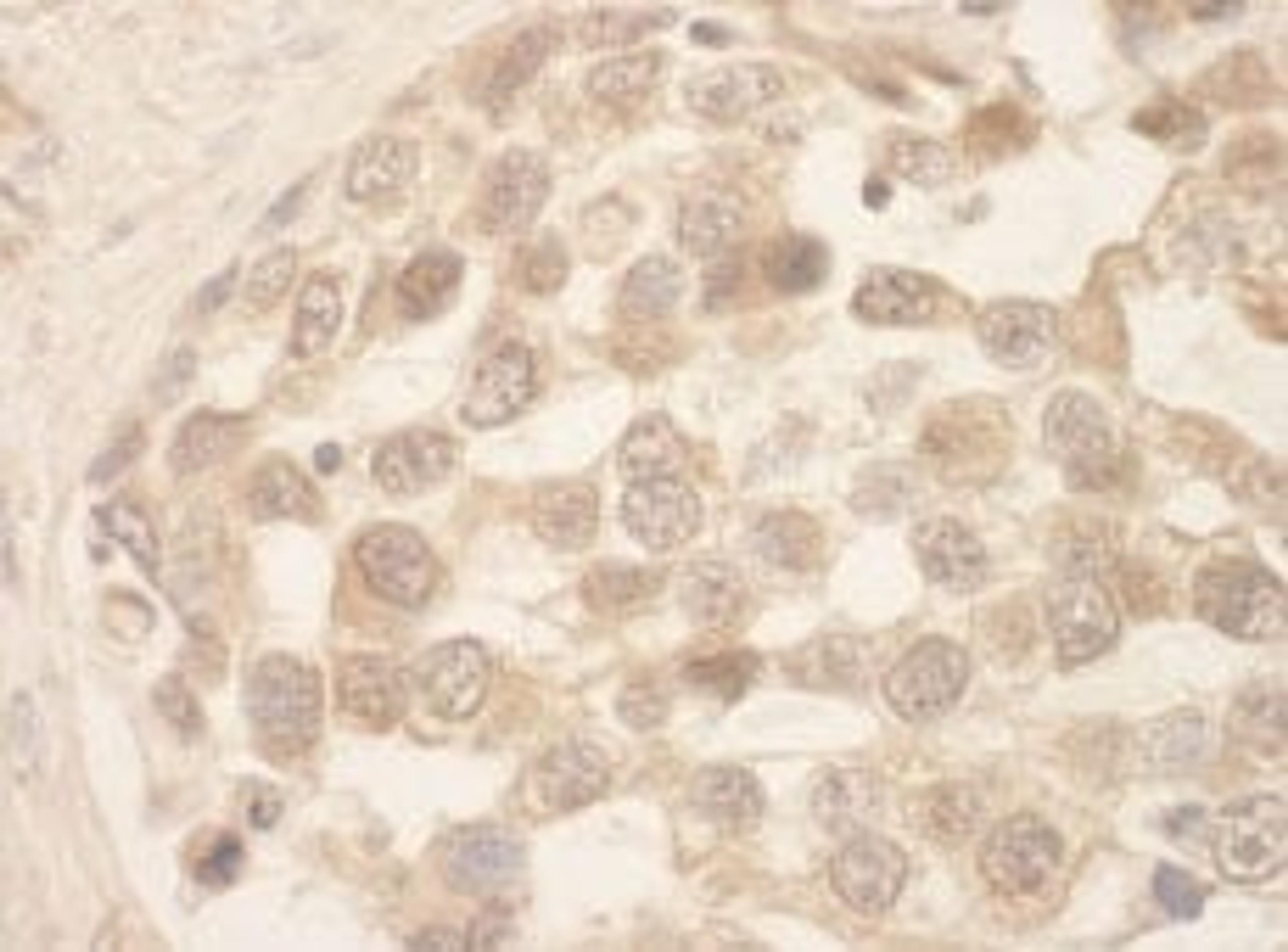 Detection of human SRPK1 by immunohistochemistry.